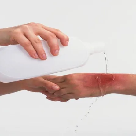 في الشرقية مبادئ الإسعافات الأولية داخل المنزل للنساء