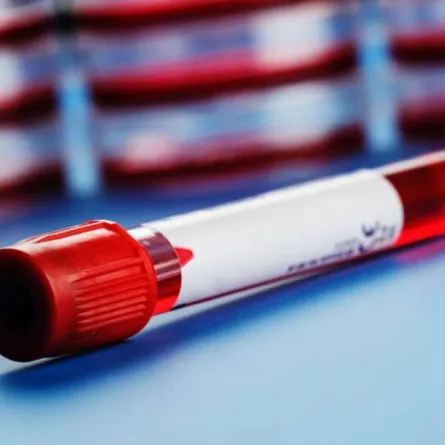 مرض السرطان: فحص دم جديد للكشف المبكر