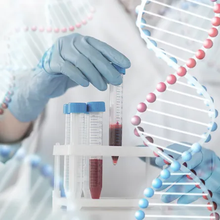 نجلاء الردادي.. مخترعة سعودية تواجه الأورام السرطانية