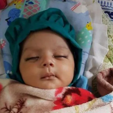 أطباء في الهند يقتلعون 7 أسنان من فم رضيع