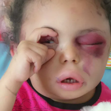 بالفيديو والصور.. الطفلة «بثينة» الناجية الوحيدة من أسرتها وتعاطف عالمي معها!