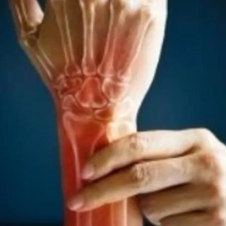 تنمية عظام بشرية للمرة الأولى في المختبر