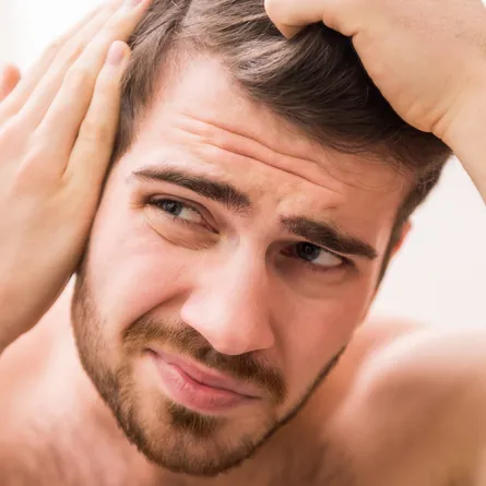 الثعلبة: داء غير معدٍ يُفقد الشعر وهذه هي علاجاته