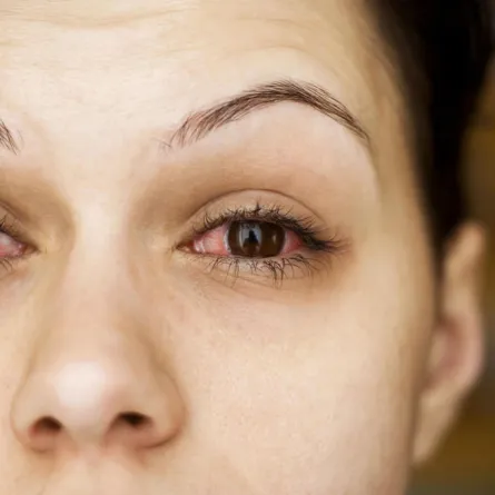 فتاة شابة تذرف دموعاً بنفسجية اللون!