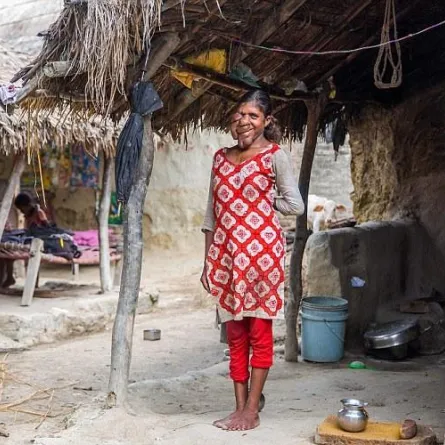 بالفيديو: مرض نادر يحبس هذه الفتاة في منزلها طوال حياتها