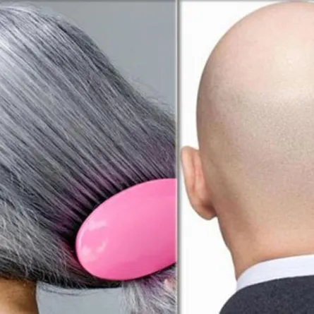 العلماء يكتشفون «سر» الشعر الأبيض والصلع.. أخيراً!