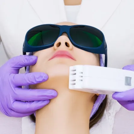 متى يسمح للفتاة استخدام تقنية الليزر للأماكن الحساسة؟