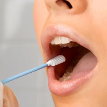 الاسنان...تأثير اضطرابات تركيبة اللعاب والعلاجات