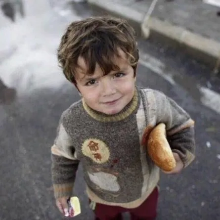 في القرن العشرين الأطفال الفقراء أكثر سمنة من الأثرياء