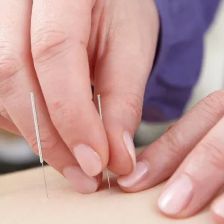 آلام الدورة الشهرية: للتخلص منها فكّري بـ الطب الصيني