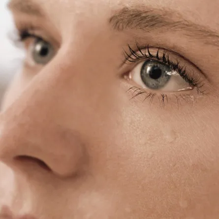 التهاب القرنية: علاج العمى الثلجي الناتج عن حروق الشمس في العين