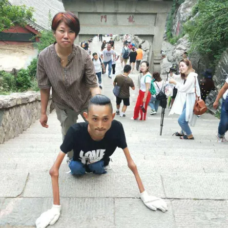 مصاب بضمور العضلات.. وينجح في تسلق الجبل الثاني