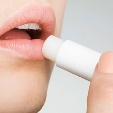 أساليب العناية بالشفاه بعد تعرّضها لأشعّة الشمس المفرطة