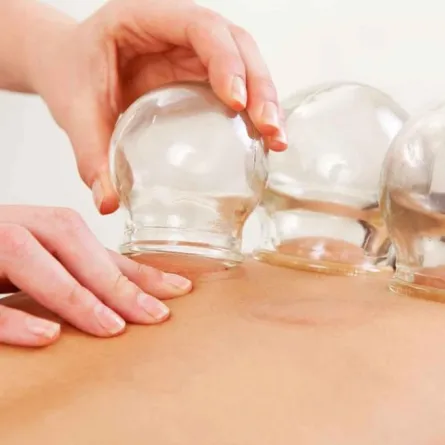 فوائد الحجامة وآثارها السلبية على الصحة