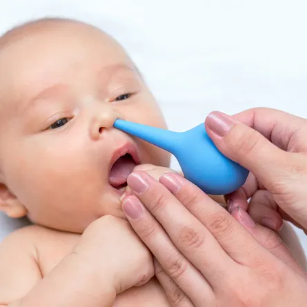 انسداد أنف الرضيع  