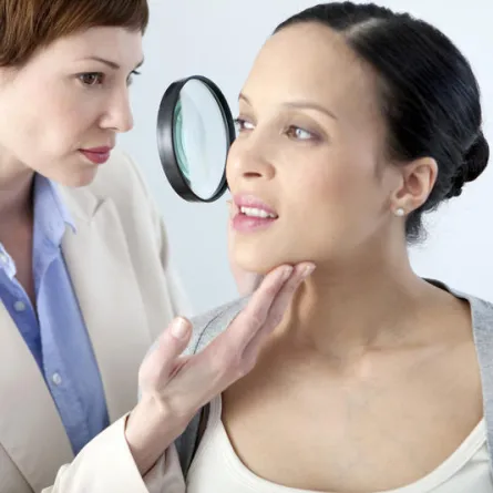 نصائح طبية لعلاج الكلف عند الحامل