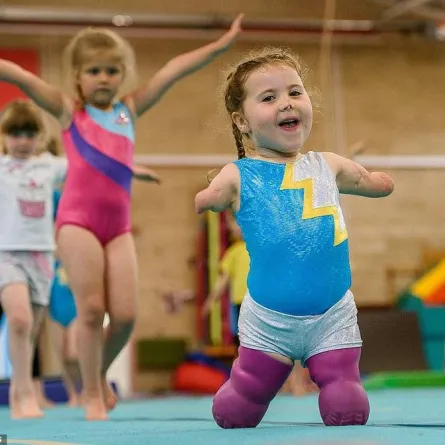 صور ..لاعبة جمباز بلا أطراف وعمرها 5 سنوات!