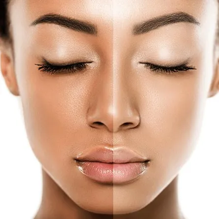 أفضل 5 خلطات لتبييض البشرة