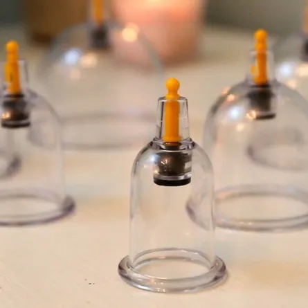 ماهي طريقة العلاج بالحجامة وأفضل أوقاتها؟