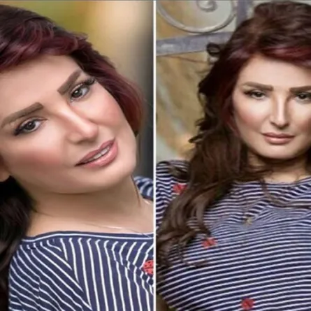 أمل رزق: ابنتي في انتظار عمل أشعة رنين على المخ 