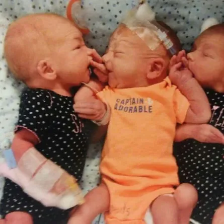 دخلت المستشفى لتفتيت حصوات فخرجت بثلاثة توائم