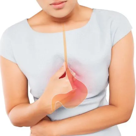 علاج حرقة المعدة طبيعيا