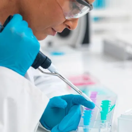 تحليل يمكنه التنبؤ بسرطان البنكرياس في مراحله المبكرة