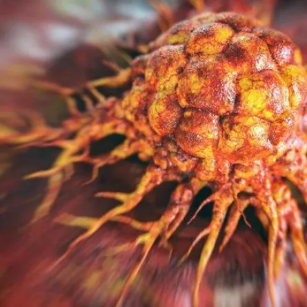 علاج جديد لقتل الخلايا السرطانية يعيد الأمل لملايين المصابين