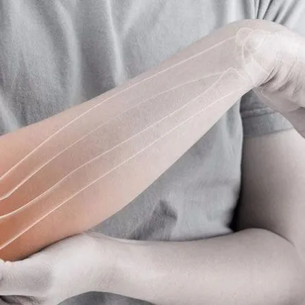 اليوم العالمي لهشاشة العظام: الكشف المبكر ينقذ عظامك من الكسور