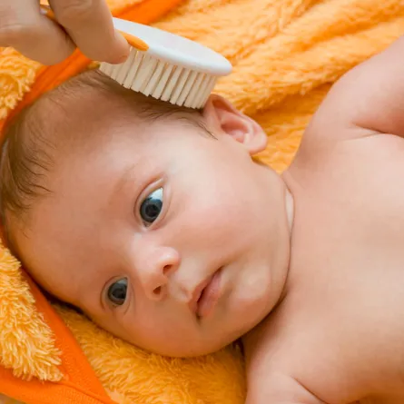 قشرة رأس المولود.. الأسباب وطرق العلاج