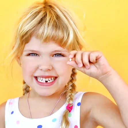  نزع سن لبني