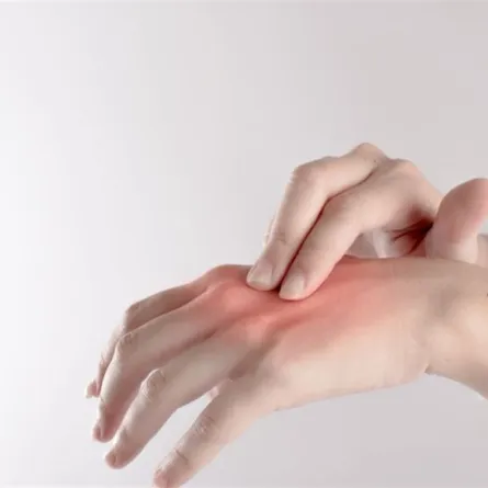 أسباب تورم اليدين خطيرة... لا تهمليها أبدًا 