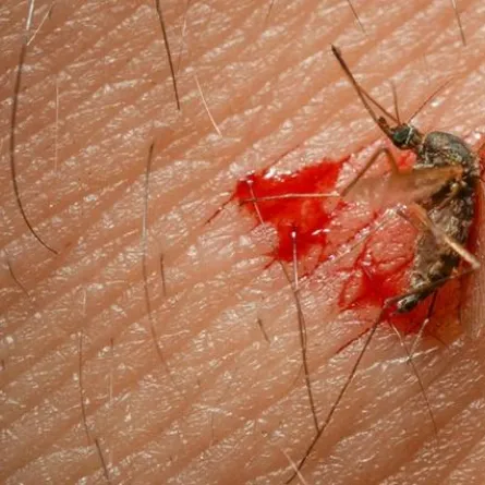 لسعة بعوضة تقتل جندياً تركياً !