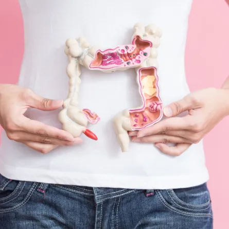 تطوير تقنية جديدة للكشف عن سرطان القولون في وقت مبكر