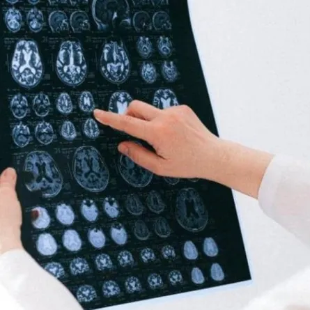 علماء يشرحون كيفية انتقال كورونا من الأنف إلى الرئتين والدماغ 