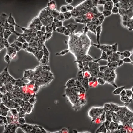 كيف يحول كورونا خلايا أدمغة الخفافيش إلى مصنع للفيروسات؟