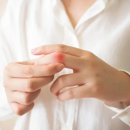 علاج الأملاح والنقرس بفعالية