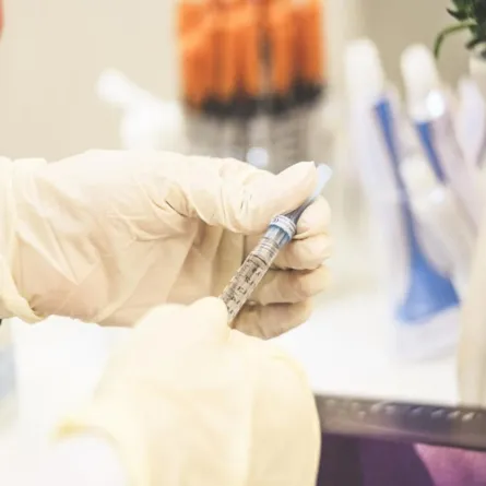 مرضى السكري: زراعة البنكرياس علاج نهائي للمرض