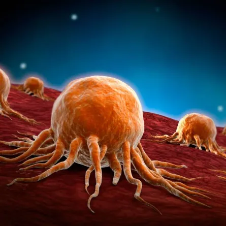 سرطان - تعبيرية