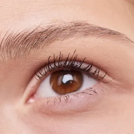 علاج الكيس الدهني بالعين