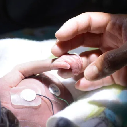 صورة لطفل خديج