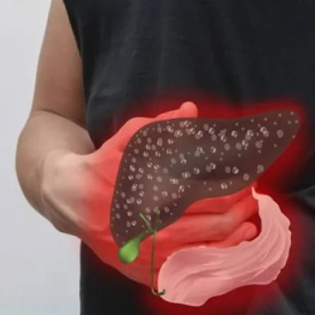 فيروس الكبد B من أنواع الالتهاب الشائعة التي تصيب الكبد وغيرها من الأعضاء