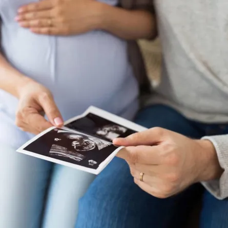 صورة للجنين