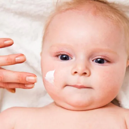 صورة لعلاج الطفل من الأكزيما