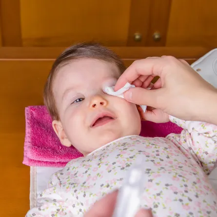 تدلي الجفن الخلقي عند الأطفال أسبابه وطرق علاجه