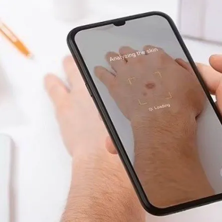 سرطان الجلد