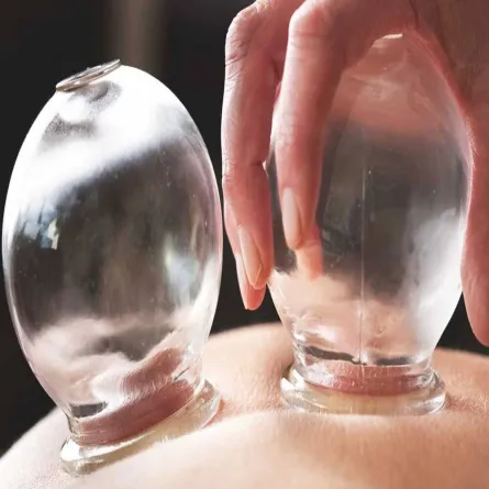 حقيقة تأثير الحجامة على زيادة فعاليات لقاحات كورونا