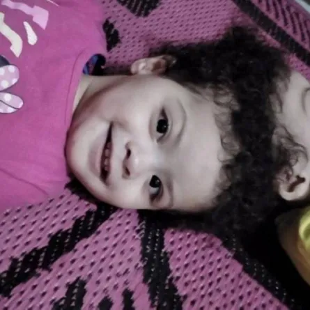 وصول التوأم السيامي المصري سارة وسلمى إلى الرياض