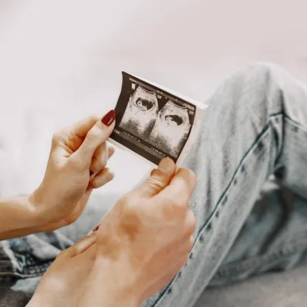 صورة لزوجين يراقبان أشعة الجنين