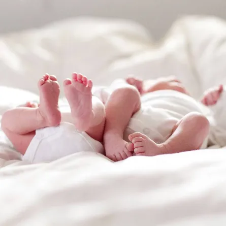 صورة لولادة توأم